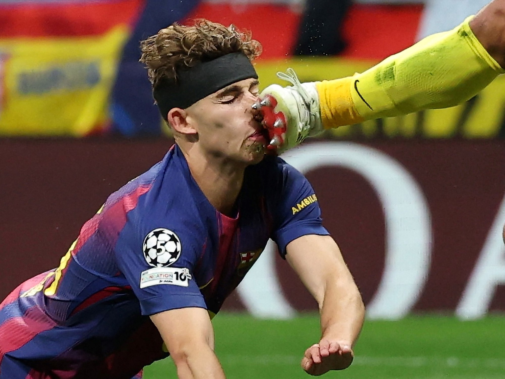 El choque de Juan Musso con Fermín López: el español terminó ensangrentado